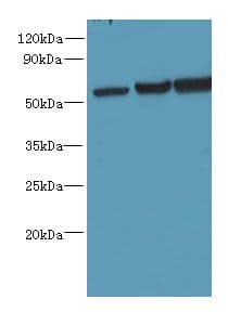 OSBPL2 Antibody