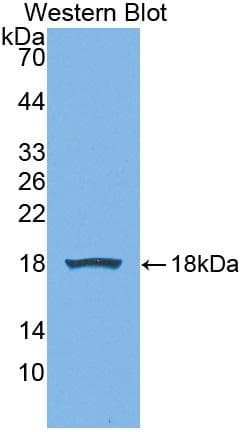 Preprovasopressin Antibody (aa24-168)