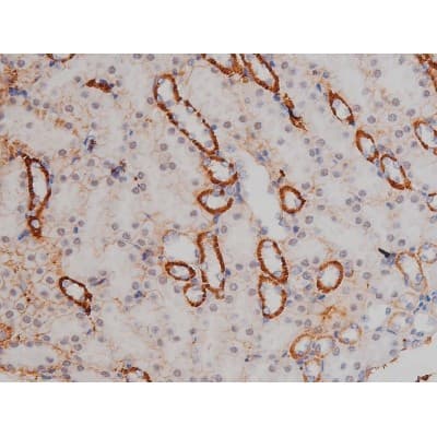 NPM1 / NPM / Nucleophosmin Antibody (phospho-Thr199)