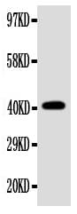 EDA / Ectodysplasin A Antibody (aa254-269)