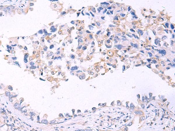 GRIA2 / GLUR2 Antibody