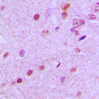 NEUROD2 Antibody (Internal)