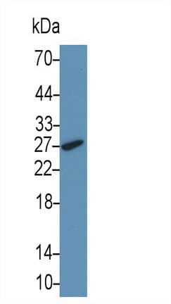 F3 / CD142 / Tissue factor Antibody (aa34-251)