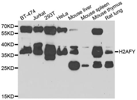 H2AFY / MACROH2A1 Antibody