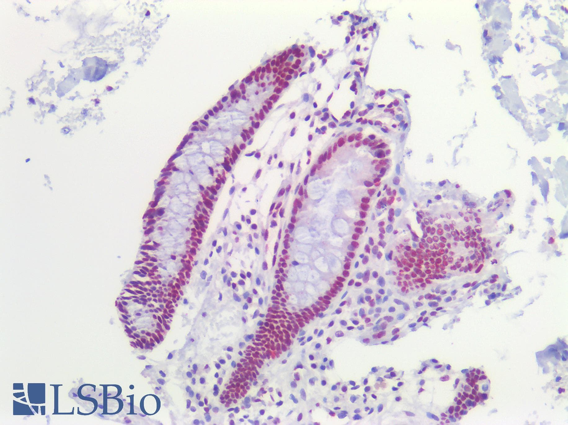 PathPlus™ CBFA1 / RUNX2 Antibody (clone 4D5)