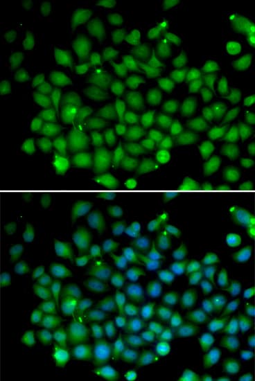FAT10 / UBD Antibody