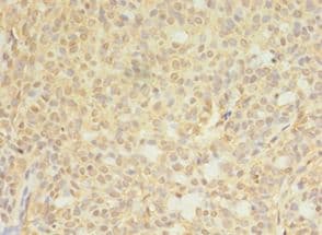 CTPS Antibody (aa79-388)