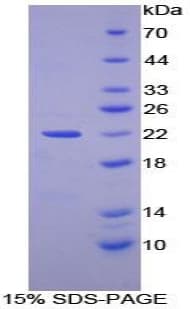 Mouse ZIF268 / EGR1 Protein (Recombinant His, N-Terminal)