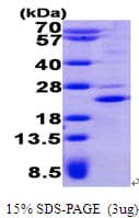 Human PHLDA2 / TSSC3 Protein (Recombinant His)