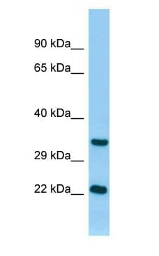 Polyclonal Rabbit anti-Rat TNNI3 / Cardiac Troponin I Antibody (N-Terminus, WB)