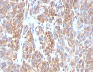 BCL2 / Bcl-2 Antibody (clone ARBC2-1, Ready-to-Use)