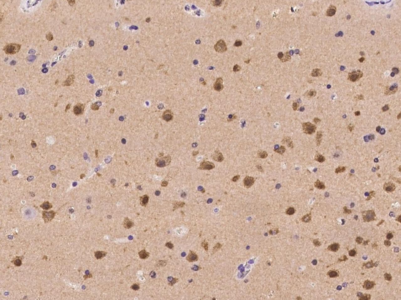 RGS6 Antibody