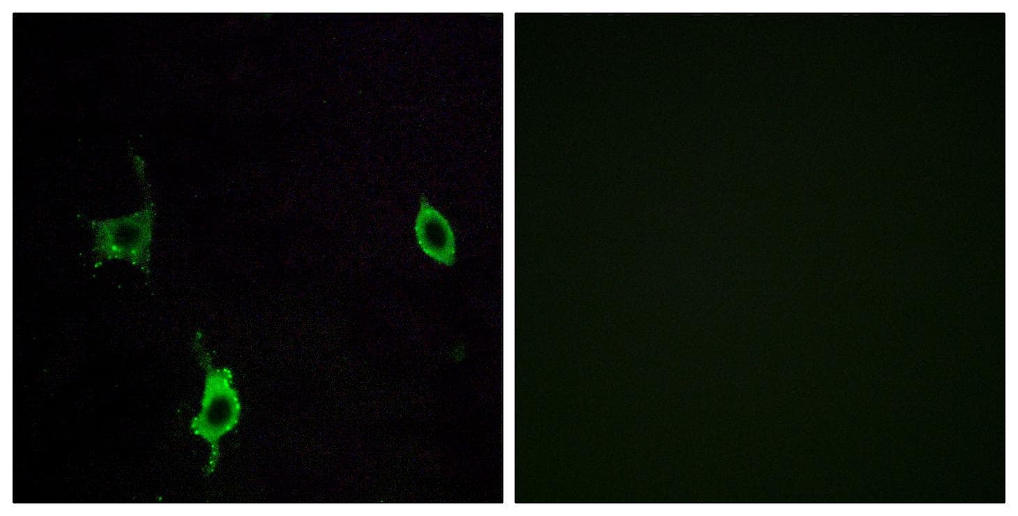 Polyclonal Rabbit anti-Human LAMC3 / Laminin Gamma 3 Antibody (IHC, IF)
