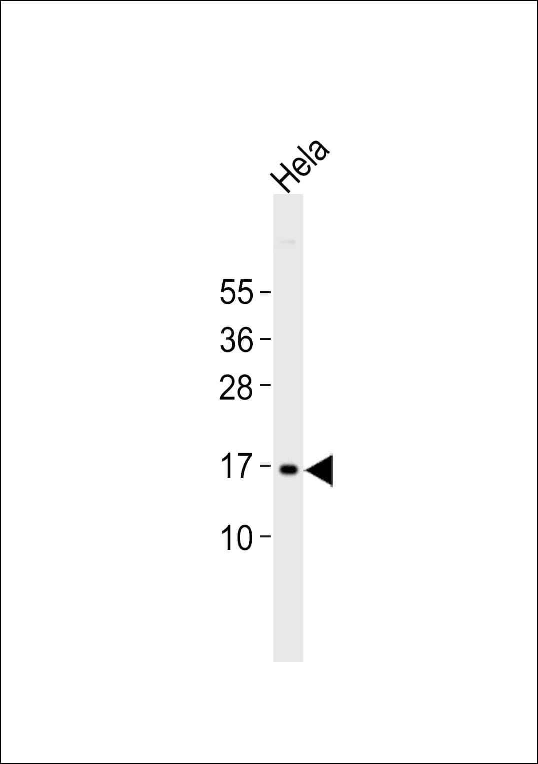 Polyclonal Rabbit anti-Human p14ARF / CDKN2A Antibody (WB)