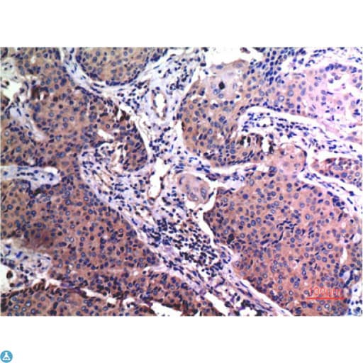 MMP2 Antibody