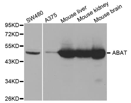 IHC-plus™ ABAT Antibody