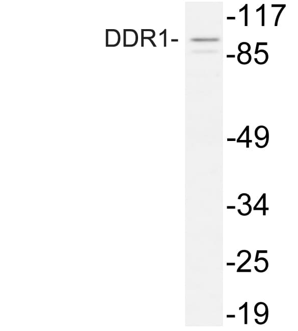 NEP / DDR1 Antibody (aa749-798)