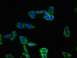 Polyclonal Rabbit anti-Human TIGIT Antibody
