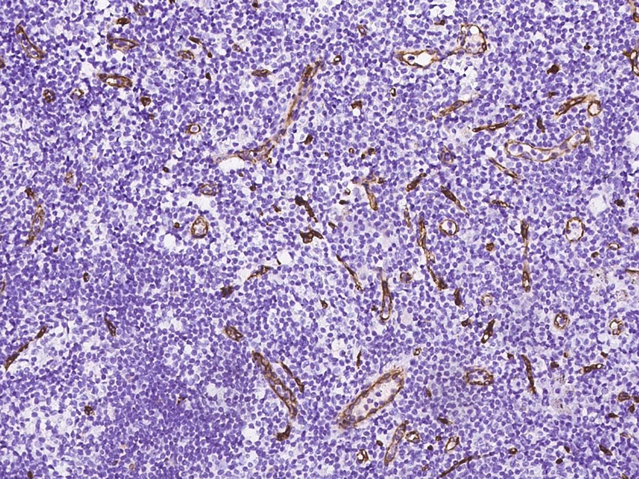 NES / Nestin Antibody