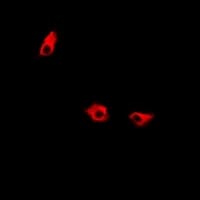 Polyclonal Rabbit anti-Human KIF2B Antibody (IHC, IF, WB)