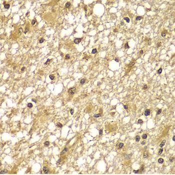 PIK3R3 / p85 Gamma Antibody