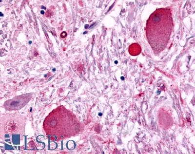 PathPlus™ FSH Receptor / FSHR Antibody (N-Terminus)