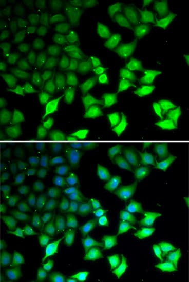 KDM4B / JMJD2B Antibody