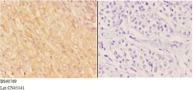 ADAMTS18 Antibody