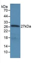 RNASEL / RNase L Antibody (aa358-583, PE)