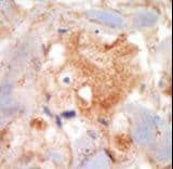 c-Kit / CD117 Antibody (aa9-40)