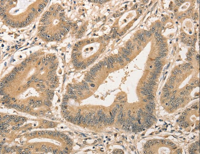 CDCA8 / Borealin Antibody