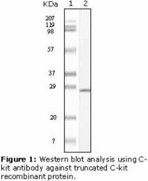 c-Kit / CD117 Antibody (clone 8D7B4, 8D7D4, 7H6B2, 7H6B12)