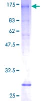 Human SLC26A3 / DRA Protein (Recombinant GST)