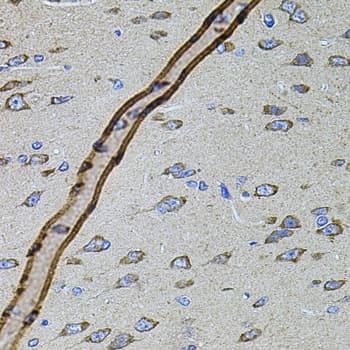 CYBB / NOX2 / gp91phox Antibody