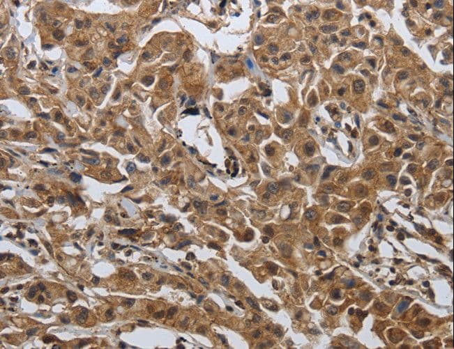 Polyclonal Rabbit anti-Human PDCD7 Antibody (IHC)