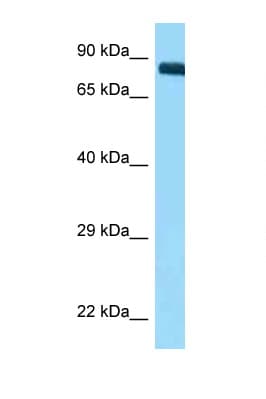 Polyclonal Rabbit anti-Human ITGB3 / Integrin Beta 3 / CD61 Antibody (aa58-107, WB)