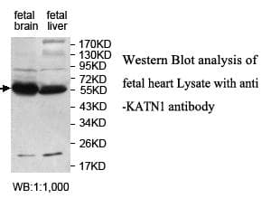 KATNA1 Antibody (aa103-283)