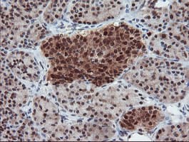 UBE2E3 Antibody (clone OTI7E8)
