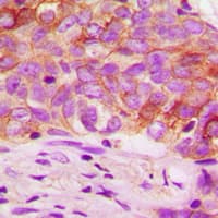 Polyclonal Rabbit anti-Human EZR / Ezrin Antibody (phospho-Thr567, IHC, WB)