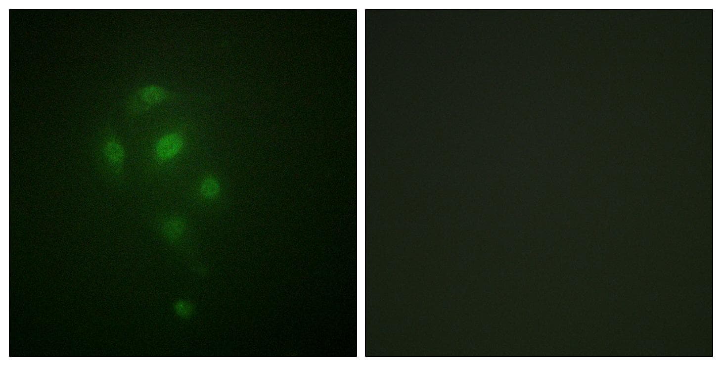 RPS6KA5 / MSK1 Antibody (phospho-Thr581)