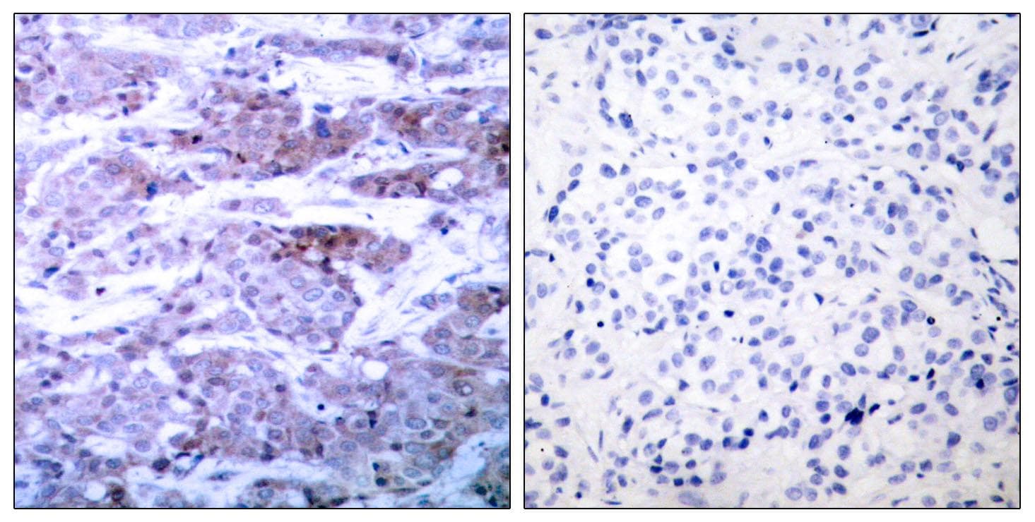 BAD Antibody (p112)