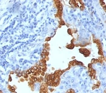 Cytokeratin 8+18 Antibody (clone SPM141)