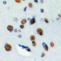 RFWD3 Antibody (Internal)