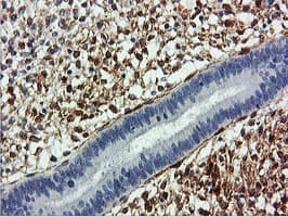 Monoclonal Mouse anti-Human TAGLN / Transgelin / SM22 Antibody (clone 8C8, Carrier-free, IHC, IF, WB)