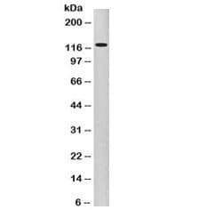 CDH3 / P-Cadherin Antibody (clone 6A9)