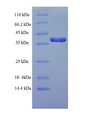 Human DUSP13 Protein (Recombinant His-SUMO)