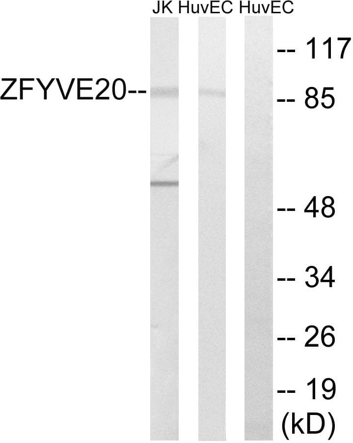 Polyclonal Rabbit anti-Human RBSN / Rabenosyn 5 Antibody (WB)