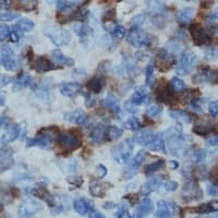 CD32B Antibody (C-Terminus)