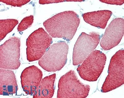 IHC-plus™ TNNC2 Antibody (aa1-160)