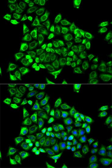 IHC-plus™ CDA / Cytidine Deaminase Antibody